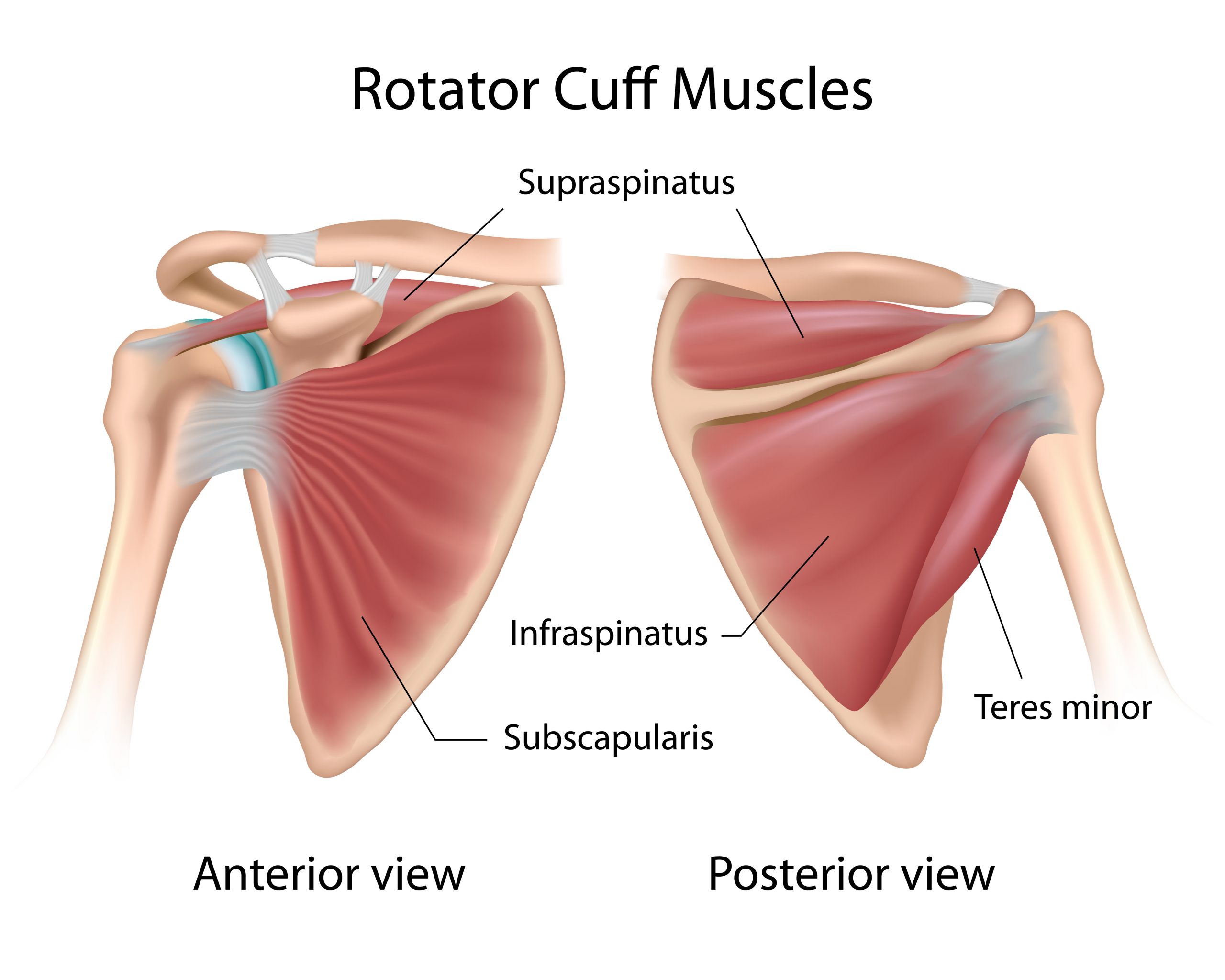 Getting around rotator cuff injuries - Pain Care Clinic LTD